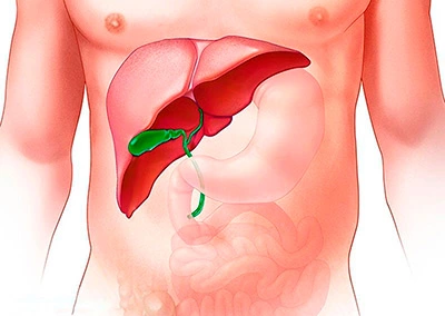 Рак желчного пузыря: симптомы, диагностика и лечение ✋